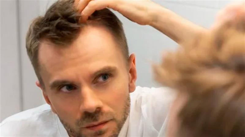 /image/0mqguzSnZf32jBDM6ORY0j1t6mCO1hVTzCKVp2fm.jpg CAÍDA DEL CABELLO: Todo lo que necesitas saber para cuidar tu cabello