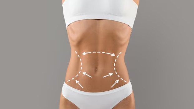 Reducción Abdominal con Hidrolipoclasia