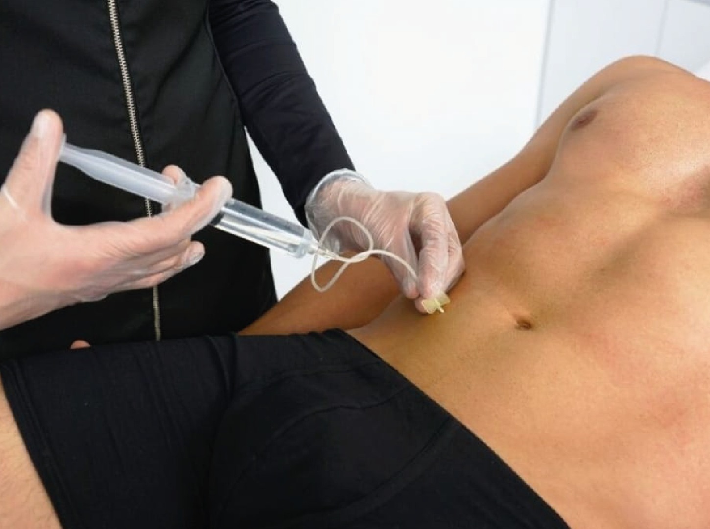 /image/eJEERDDcBO8FfXcX6d8cq0Kg6zjAdrMH8NyIsFbk.jpg Hidrolipoclasia: Qué es, resultados y beneficios